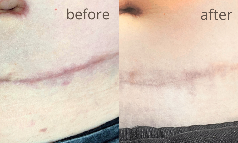 Before-after  (4)