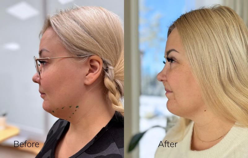 Kopio mallista länderikuvat-7