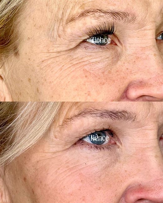 Woman 57 before and after, with logo Woman 57 before and after, with logo