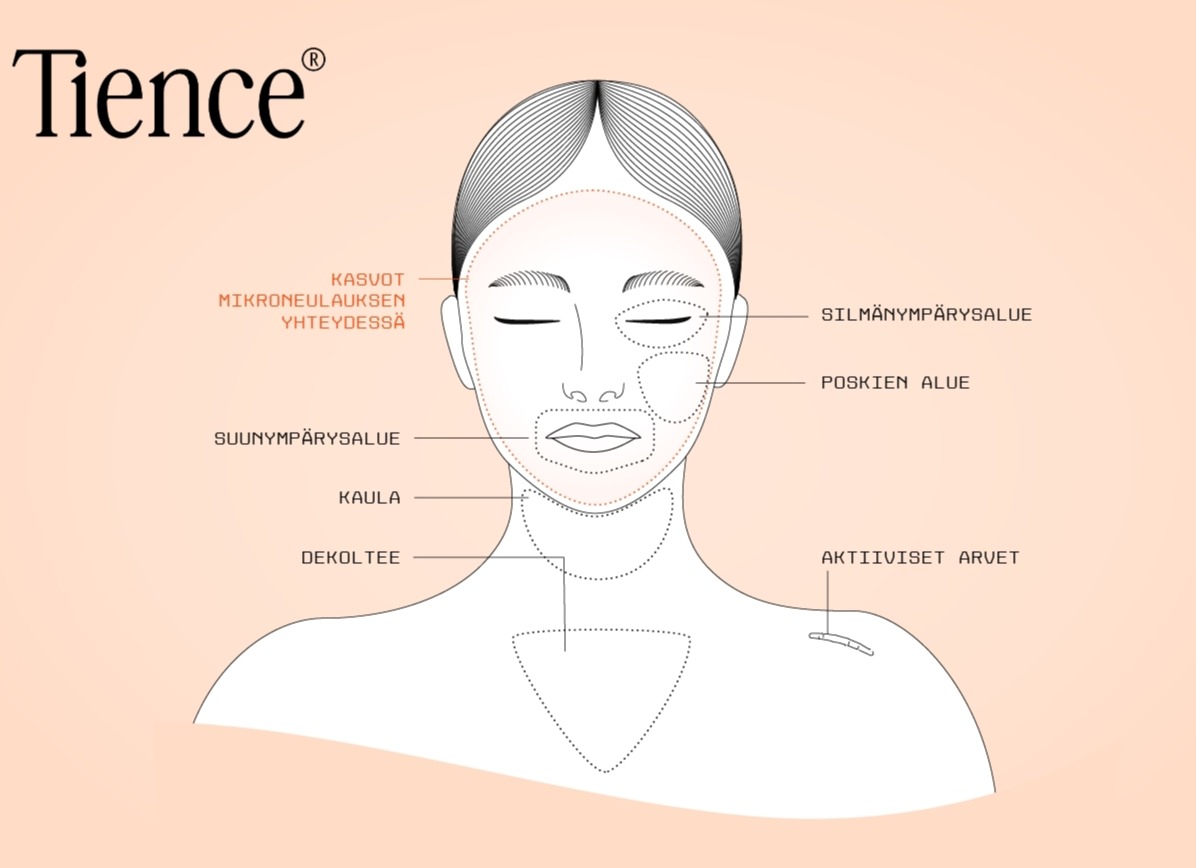 Hoitoalueet päivitetty 2 Hoitoalueet päivitetty 2